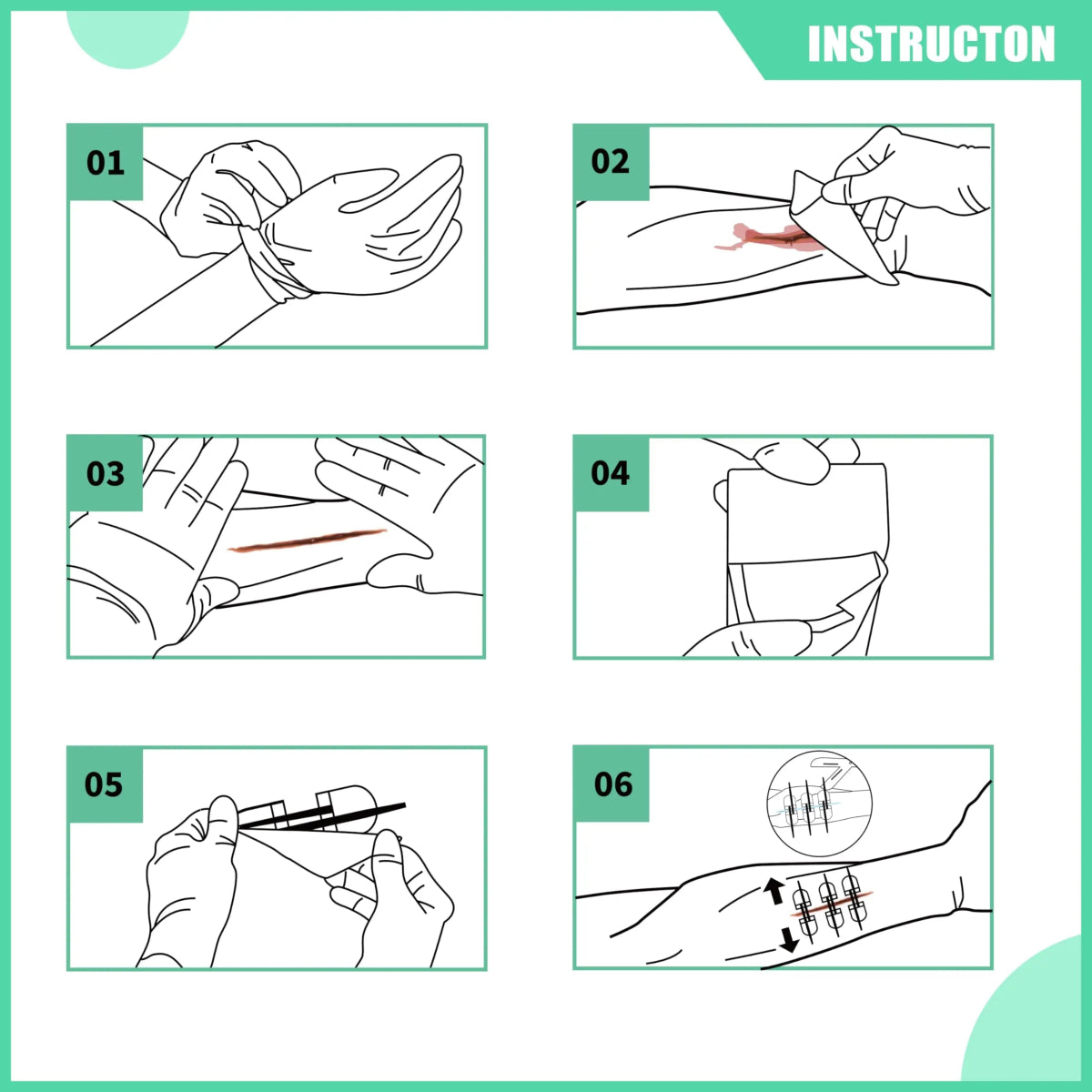 Kit de fermeture complet sans suture avec bandes de fermeture de plaies 6 Pièces "RHINO RESCUE - Wound Closure Kit" - Planète Rando