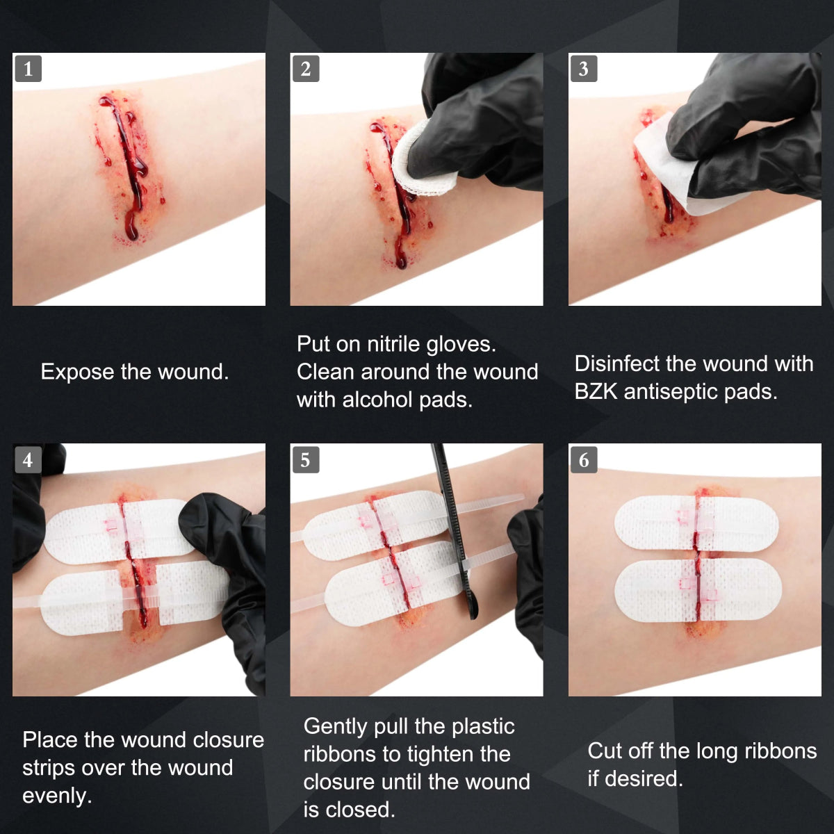 Kit de fermeture complet sans suture avec bandes de fermeture de plaies 6 Pièces "RHINO RESCUE - Wound Closure Kit" - Planète Rando